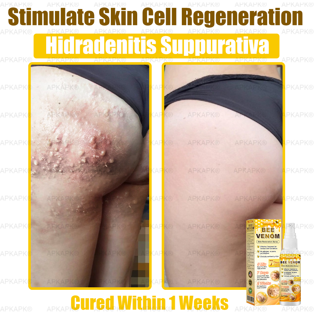 š APKAPKĀ® has a surprise upgrade just for you! Youāve already received an amazing offer ā but now youāve unlocked an even better one: š„ Get a massive 50% OFF your next purchase of APKAPKĀ® Bee Venom Skin Restoration Spray ā for the next two minutes only!