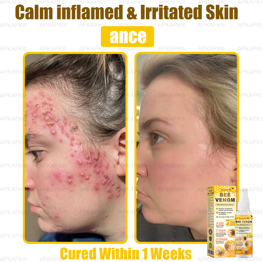 š APKAPKĀ® has a surprise upgrade just for you! Youāve already received an amazing offer ā but now youāve unlocked an even better one: š„ Get a massive 50% OFF your next purchase of APKAPKĀ® Bee Venom Skin Restoration Spray ā for the next two minutes only!
