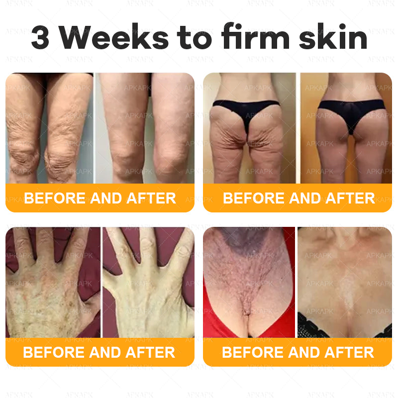 Only 10 jars! Grab an exclusive 50% discount now! APKAPK™ Keep your skin youthful and glowing in just 1 to 3 weeks. Don’t miss your chance—this offer won’t come around again until next year. Act fast! 180-day money back guarantee!