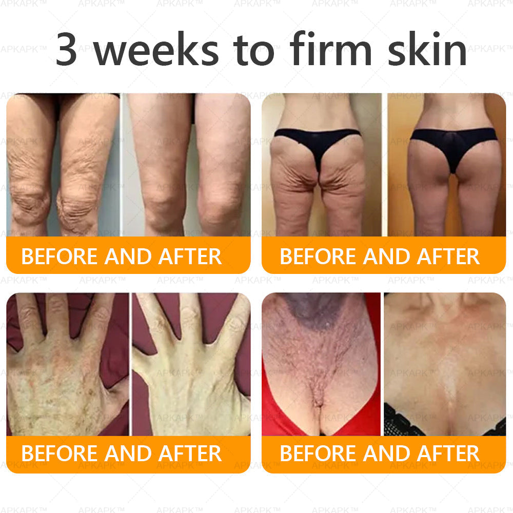 š„ For a limited time only: 50% off AŠ KAŠ Šā¢ Bee Venom Comprehensive Cream ā for the next 2 minutes! Donāt miss out ā this exclusive upgrade is available for a short time only! š„