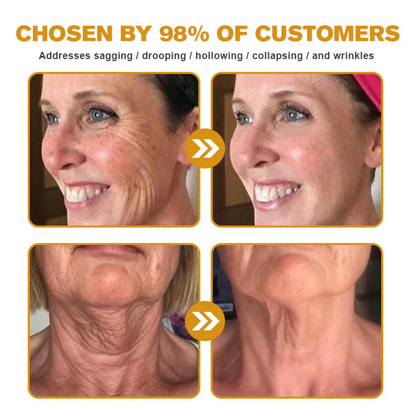 🇬🇧 St John's Institute of Dermatology Official: AllyBee® Skin Treatment Cream Anti-aging, Hydrating, Skin Repair, Even Tone, Acne and Dark Spot Treatment, Wart and Mole Removal, Psoriasis Relief