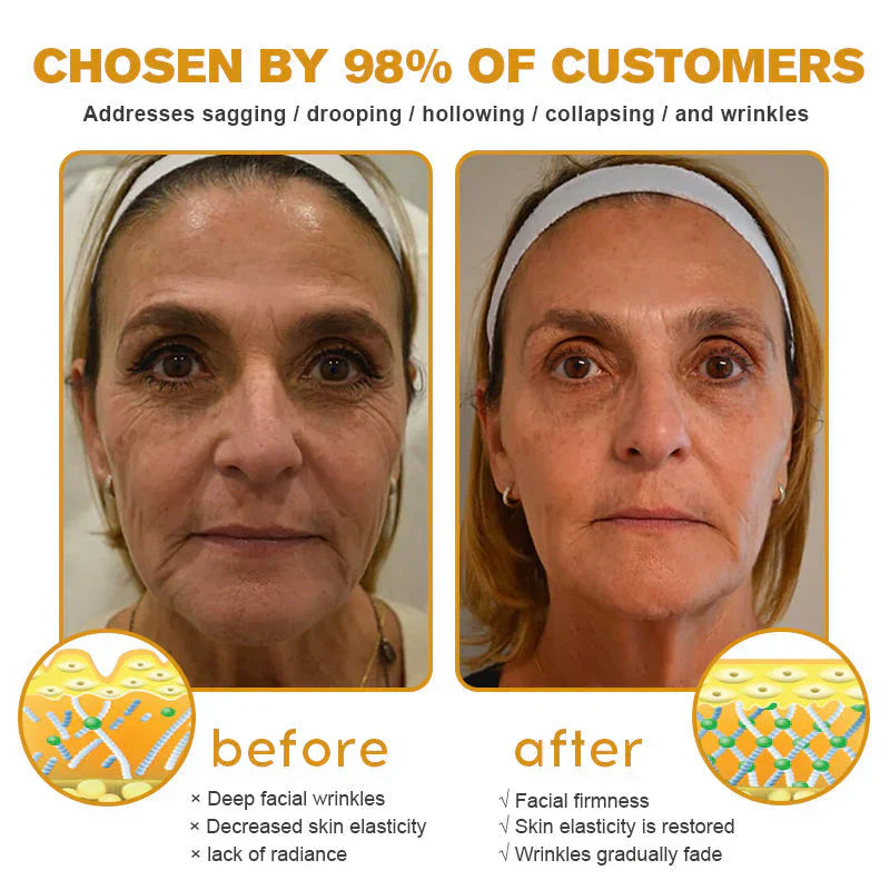 🇬🇧 St John's Institute of Dermatology Official: AllyBee® Skin Treatment Cream Anti-aging, Hydrating, Skin Repair, Even Tone, Acne and Dark Spot Treatment, Wart and Mole Removal, Psoriasis Relief