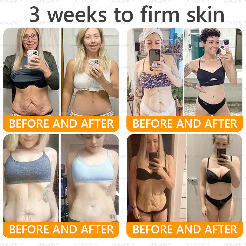 Only 10 jars! Grab an exclusive 50% discount now! APKAPK™ Keep your skin youthful and glowing in just 1 to 3 weeks. Don’t miss your chance—this offer won’t come around again until next year. Act fast! 180-day money back guarantee!