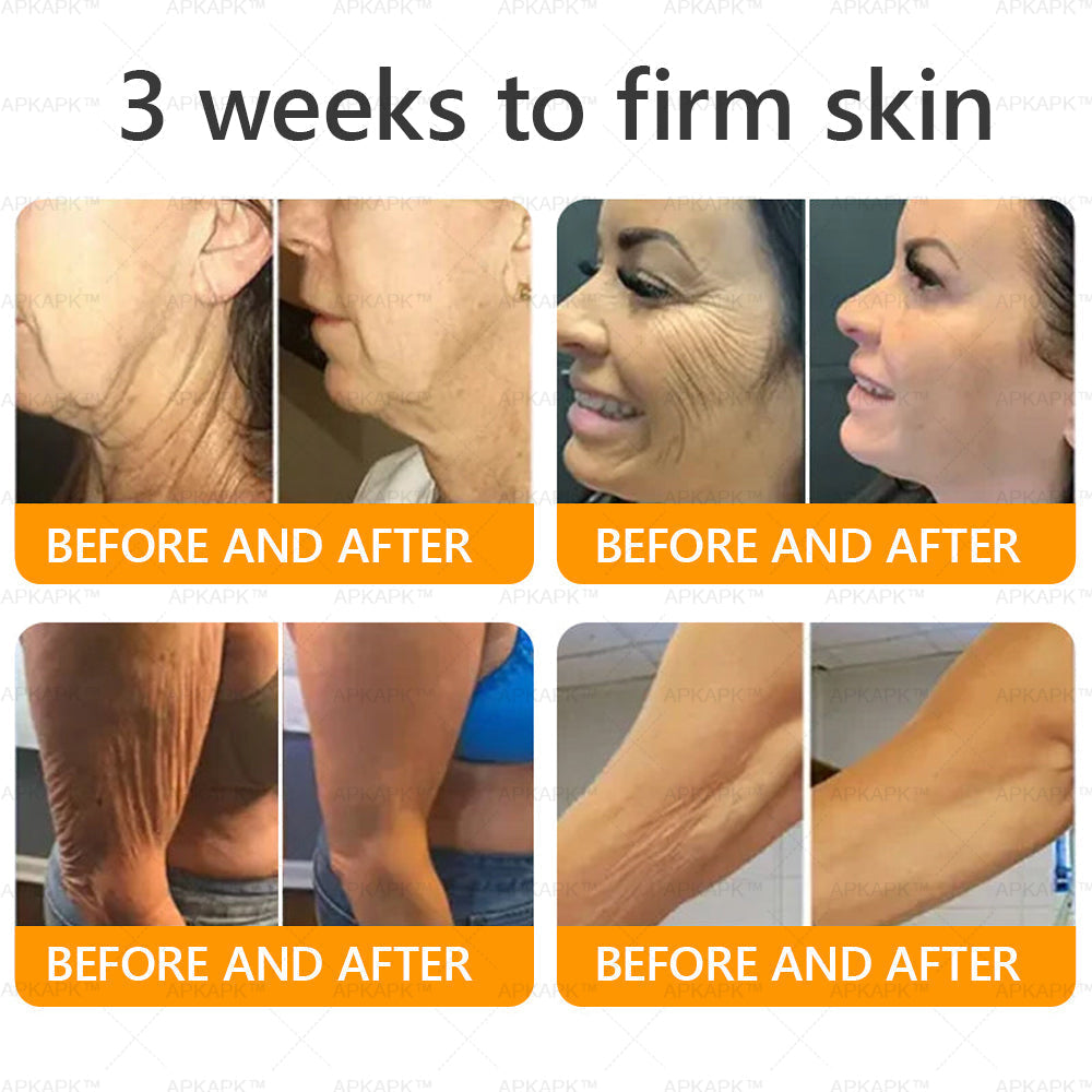 Only 10 jars! Grab an exclusive 50% discount now! APKAPK™ Keep your skin youthful and glowing in just 1 to 3 weeks. Don’t miss your chance—this offer won’t come around again until next year. Act fast! 180-day money back guarantee!