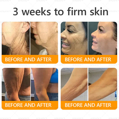 Only 10 jars! Grab an exclusive 50% discount now! APKAPK™ Keep your skin youthful and glowing in just 1 to 3 weeks. Don’t miss your chance—this offer won’t come around again until next year. Act fast! 180-day money back guarantee!