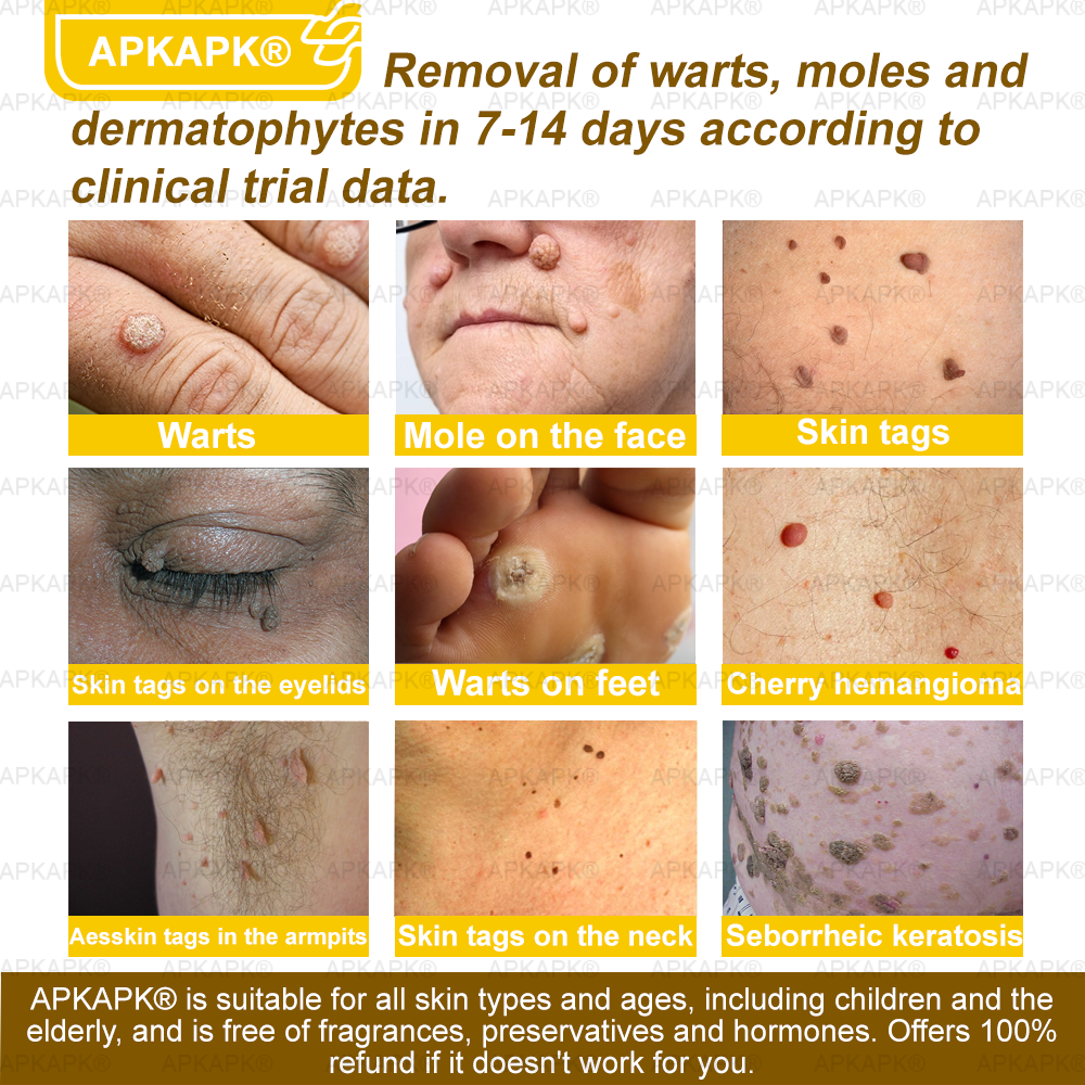 🎁 APKAPK® has a surprise upgrade just for you! You’ve already received an amazing offer — but now you’ve unlocked an even better one: 💥 Get a massive 50% OFF your next purchase of APKAPK® Bee Venom Skin Restoration Spray — for the next two minutes only!