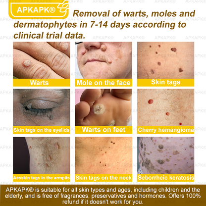 🎁 APKAPK® has a surprise upgrade just for you! You’ve already received an amazing offer — but now you’ve unlocked an even better one: 💥 Get a massive 50% OFF your next purchase of APKAPK® Bee Venom Skin Restoration Spray — for the next two minutes only!