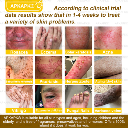 🎁 APKAPK® has a surprise upgrade just for you! You’ve already received an amazing offer — but now you’ve unlocked an even better one: 💥 Get a massive 50% OFF your next purchase of APKAPK® Bee Venom Skin Restoration Spray — for the next two minutes only!
