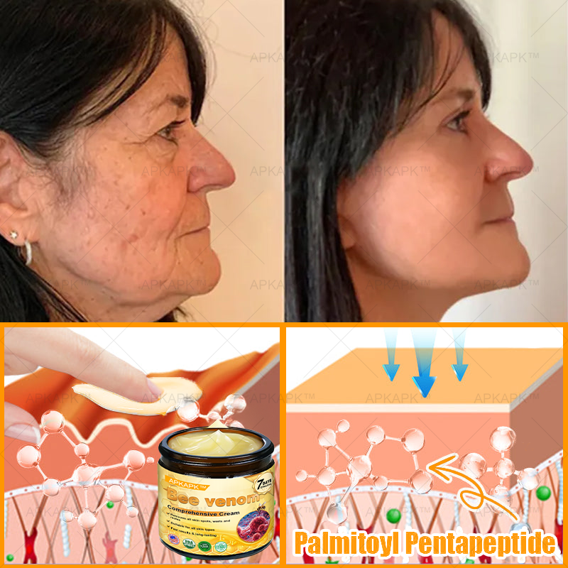 💥 For a limited time only: 50% off AРKAРК™ Bee Venom Comprehensive Cream – for the next 2 minutes! Don’t miss out – this exclusive upgrade is available for a short time only! 💥