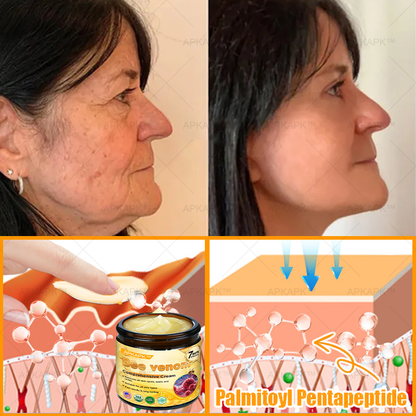 💥 For a limited time only: 50% off AРKAРК™ Bee Venom Comprehensive Cream – for the next 2 minutes! Don’t miss out – this exclusive upgrade is available for a short time only! 💥