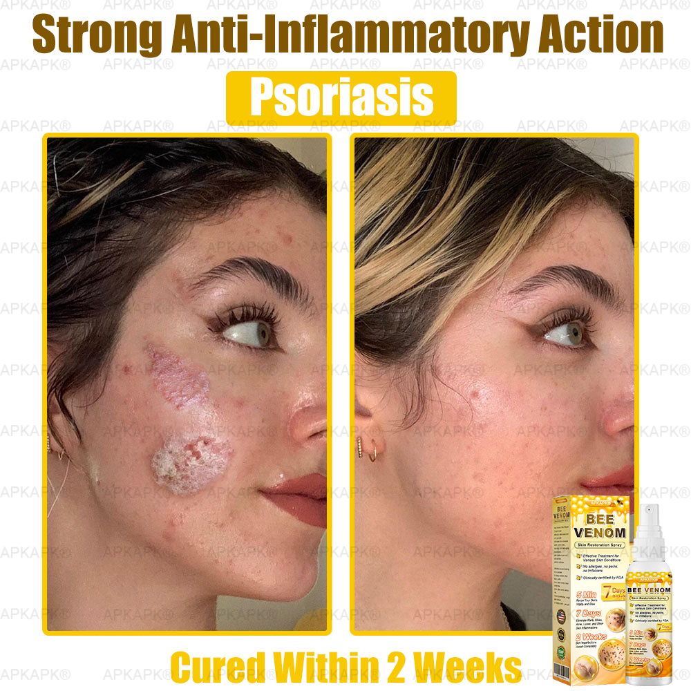 🎁 APKAPK® has a surprise upgrade just for you! You’ve already received an amazing offer — but now you’ve unlocked an even better one: 💥 Get a massive 50% OFF your next purchase of APKAPK® Bee Venom Skin Restoration Spray — for the next two minutes only!