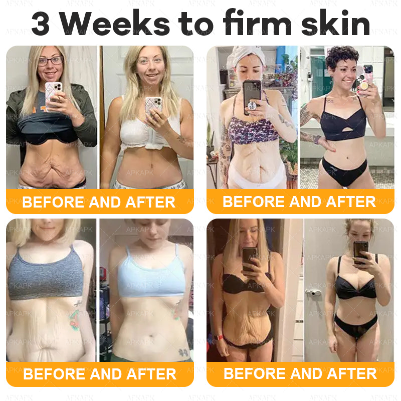 Only 10 jars! Grab an exclusive 50% discount now! APKAPK™ Keep your skin youthful and glowing in just 1 to 3 weeks. Don’t miss your chance—this offer won’t come around again until next year. Act fast! 180-day money back guarantee!