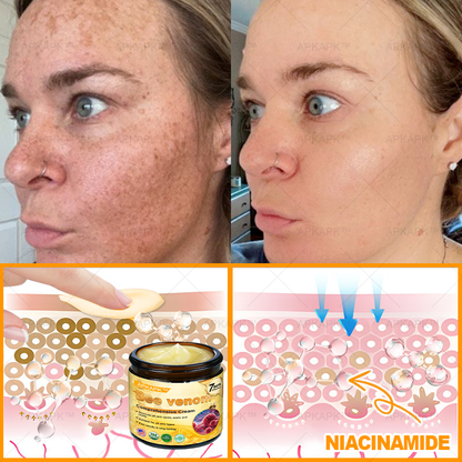 💥 For a limited time only: 50% off AРKAРК™ Bee Venom Comprehensive Cream – for the next 2 minutes! Don’t miss out – this exclusive upgrade is available for a short time only! 💥