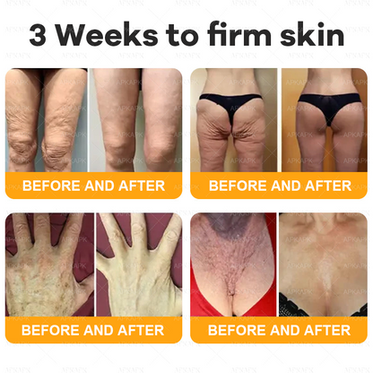 Only 10 jars! Grab an exclusive 50% discount now! APKAPK™ Keep your skin youthful and glowing in just 1 to 3 weeks. Don’t miss your chance—this offer won’t come around again until next year. Act fast! 180-day money back guarantee!