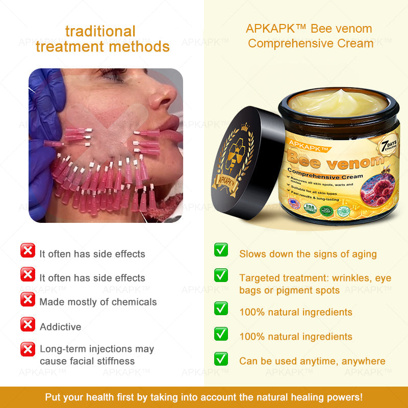 💥 For a limited time only: 50% off AРKAРК™ Bee Venom Comprehensive Cream – for the next 2 minutes! Don’t miss out – this exclusive upgrade is available for a short time only! 💥