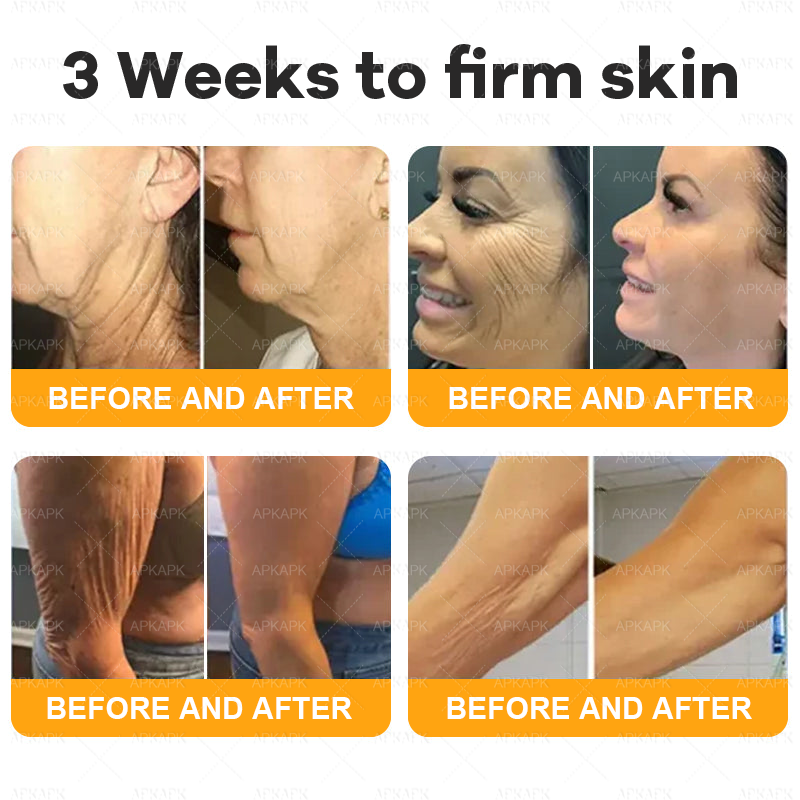 Only 10 jars! Grab an exclusive 50% discount now! APKAPK™ Keep your skin youthful and glowing in just 1 to 3 weeks. Don’t miss your chance—this offer won’t come around again until next year. Act fast! 180-day money back guarantee!
