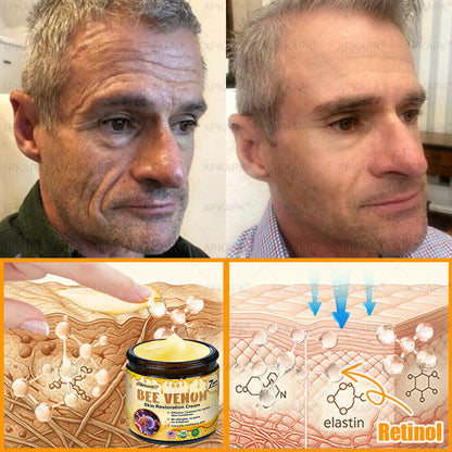 👨‍⚕️𝐌𝐇𝐑𝐀 𝐌𝐚𝐝𝐞 𝐚𝐧𝐝 𝐬𝐡𝐢𝐩𝐩𝐞𝐝 𝐟𝐫𝐨𝐦 𝐔𝐒𝐀✨𝗔𝗣𝗞𝗔𝗣𝗞® 𝗕𝗲𝗲 venom SkinRestoration Cream, Fine Lines, loss ofFirmness, Flat Bust, DroopingHips, and More