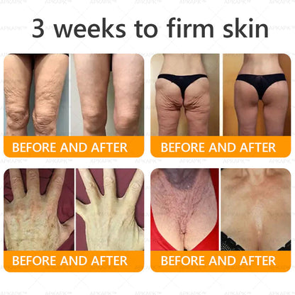 👨‍⚕️𝐌𝐇𝐑𝐀 𝐌𝐚𝐝𝐞 𝐚𝐧𝐝 𝐬𝐡𝐢𝐩𝐩𝐞𝐝 𝐟𝐫𝐨𝐦 𝐔𝐒𝐀✨𝗔𝗣𝗞𝗔𝗣𝗞® 𝗕𝗲𝗲 venom SkinRestoration Cream, Fine Lines, loss ofFirmness, Flat Bust, DroopingHips, and More