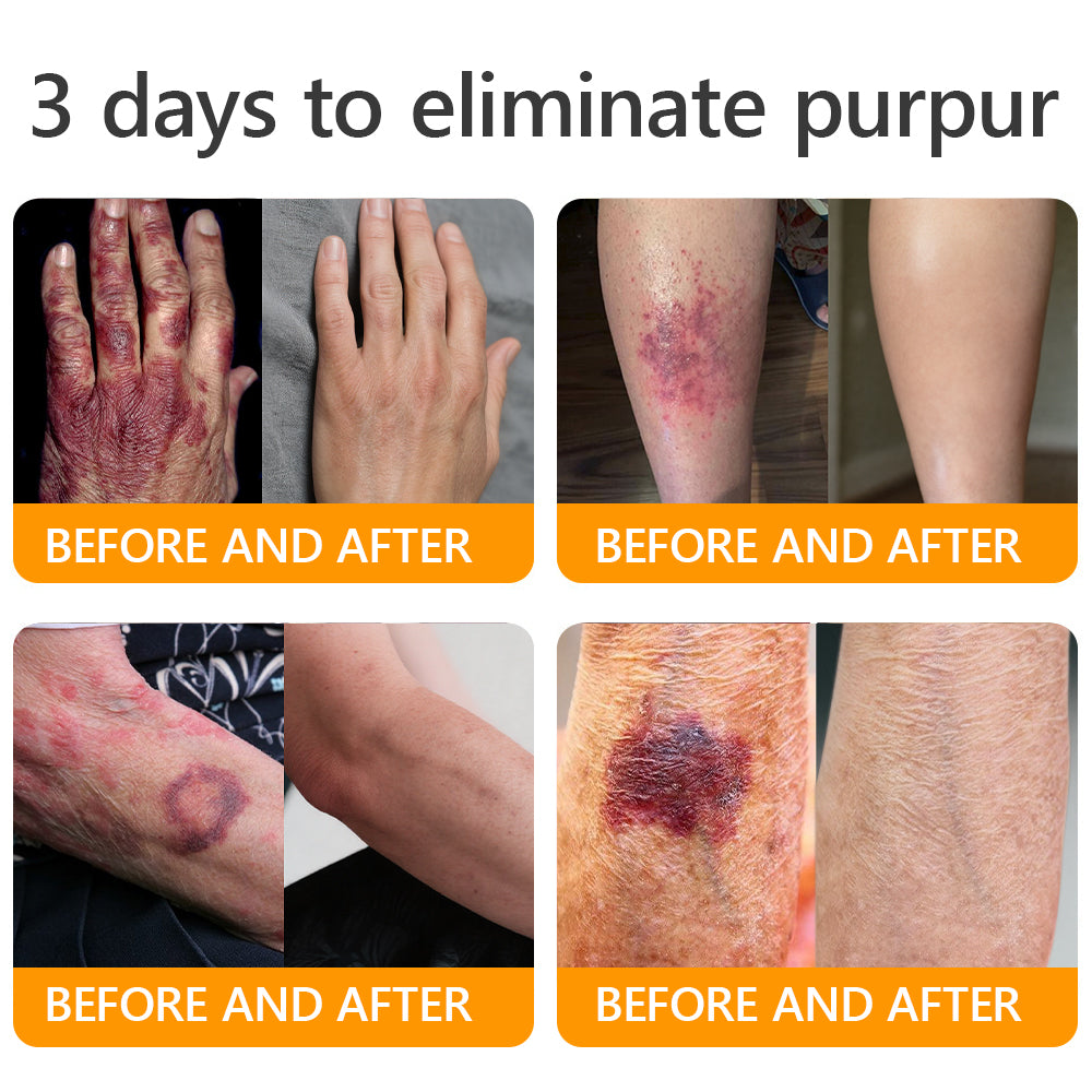 👨‍⚕️𝐌𝐇𝐑𝐀 𝐌𝐚𝐝𝐞 𝐚𝐧𝐝 𝐬𝐡𝐢𝐩𝐩𝐞𝐝 𝐟𝐫𝐨𝐦 𝐔𝐒𝐀✨𝗔𝗣𝗞𝗔𝗣𝗞® 𝗕𝗲𝗲 venom SkinRestoration Cream, Fine Lines, loss ofFirmness, Flat Bust, DroopingHips, and More