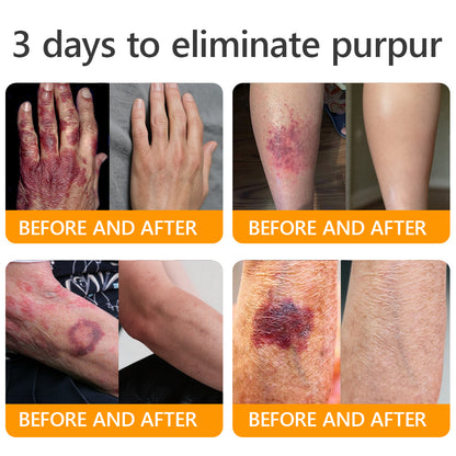 👨‍⚕️𝐌𝐇𝐑𝐀 𝐌𝐚𝐝𝐞 𝐚𝐧𝐝 𝐬𝐡𝐢𝐩𝐩𝐞𝐝 𝐟𝐫𝐨𝐦 𝐔𝐒𝐀✨𝗔𝗣𝗞𝗔𝗣𝗞® 𝗕𝗲𝗲 venom SkinRestoration Cream, Fine Lines, loss ofFirmness, Flat Bust, DroopingHips, and More