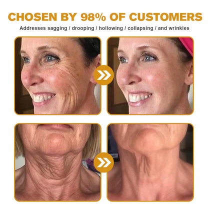 🇬🇧 St John's Institute of Dermatology Official: AllyBee® Skin Treatment Cream Anti-aging, Hydrating, Skin Repair, Even Tone, Acne and Dark Spot Treatment, Wart and Mole Removal, Psoriasis Relief