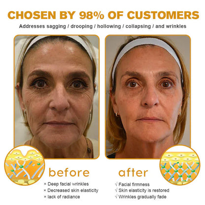 🇬🇧 St John's Institute of Dermatology Official: AllyBee® Skin Treatment Cream Anti-aging, Hydrating, Skin Repair, Even Tone, Acne and Dark Spot Treatment, Wart and Mole Removal, Psoriasis Relief